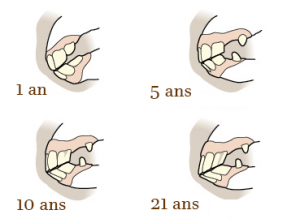 Evolution des dents du cheval